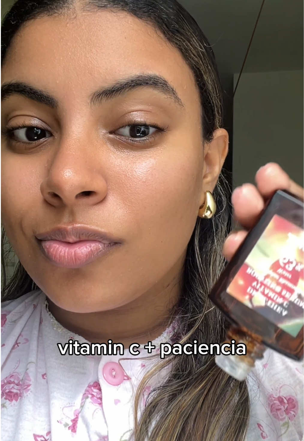 La vitamina c no puede faltar en mi rutina, es parte fundamental de mi resultado 🤌🏽 #skincare #beforeandafter #acne #hyperpigmentation 