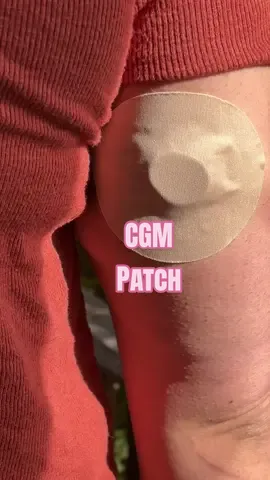 These adhesive CGM patches cover my Dexcom G7 sensor completely, leaving them looking clean… and staying put! #type1diabetes #type2diabetes #dexcom #cgm #t1d 
