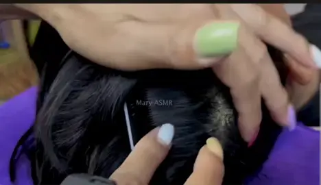 ASMR satisfying scalp care by Mary ASMR#grooming #asmrsounds #asmrvideo #scalpcare #oddlysatisfying 