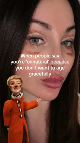 Yeh alright Karen, go get some Botox x
