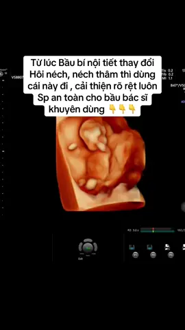 Hôi néch thâm néch cải thiện rõ rệt #xithoinach #xitkhumuihoinachhoichan #drpong #xuhuong #viralvideo 