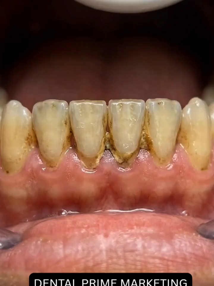 Clean teeth, confident smile!!
