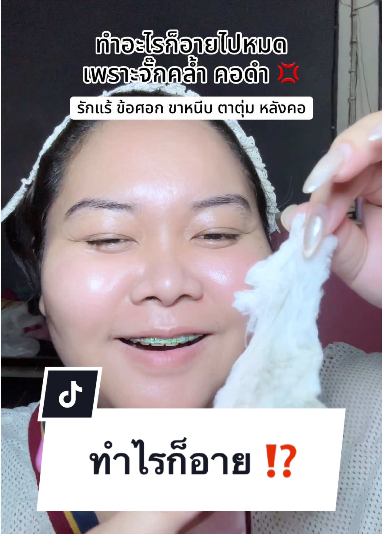 เสียความมั่นใจเพราะคอดำ ⁉️ #โทนเนอร์ #โทนเนอร์เช็ดรักแร้ #Iblancunderarmtoning 