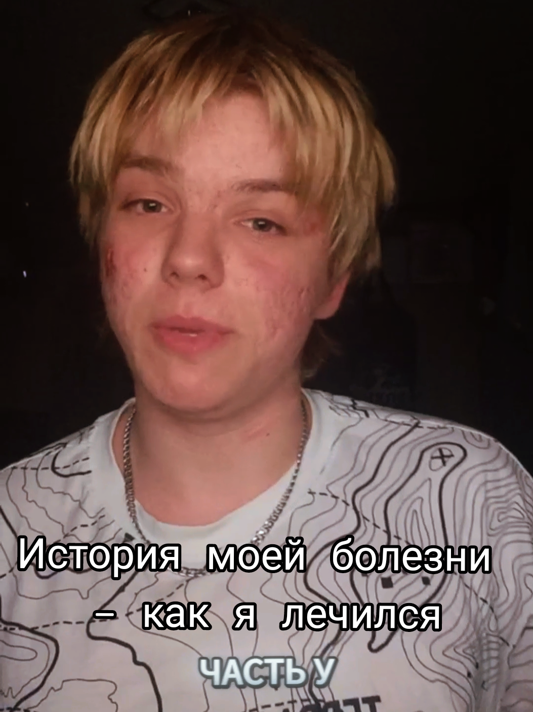 Если вам хочется узнать обо мне больше и поучаствовать в конкурсе, то вам в ТГК: Жора sharzho26 Какие-то ещё вопросы есть? Задайте, смело отвечу)  #разговорный #болезнь #историиизжизни #историяизжизни #шаржо #жора #несдаваться #лечение 