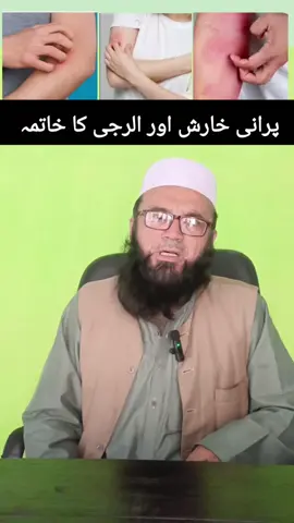 خارش اور الرجی کیلٸے #fyp #fypシ #foryoupage #unfreezemyaccount #trending 
