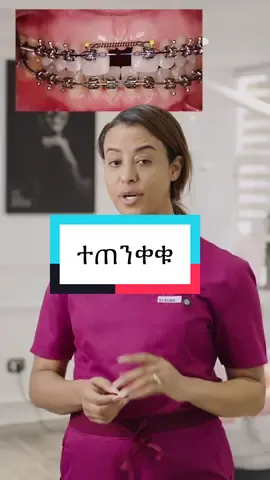 ተጠንቀቁ !!   #ethiopian_tik_tok🇪🇹🇪🇹🇪🇹🇪🇹 #fyp #viral 