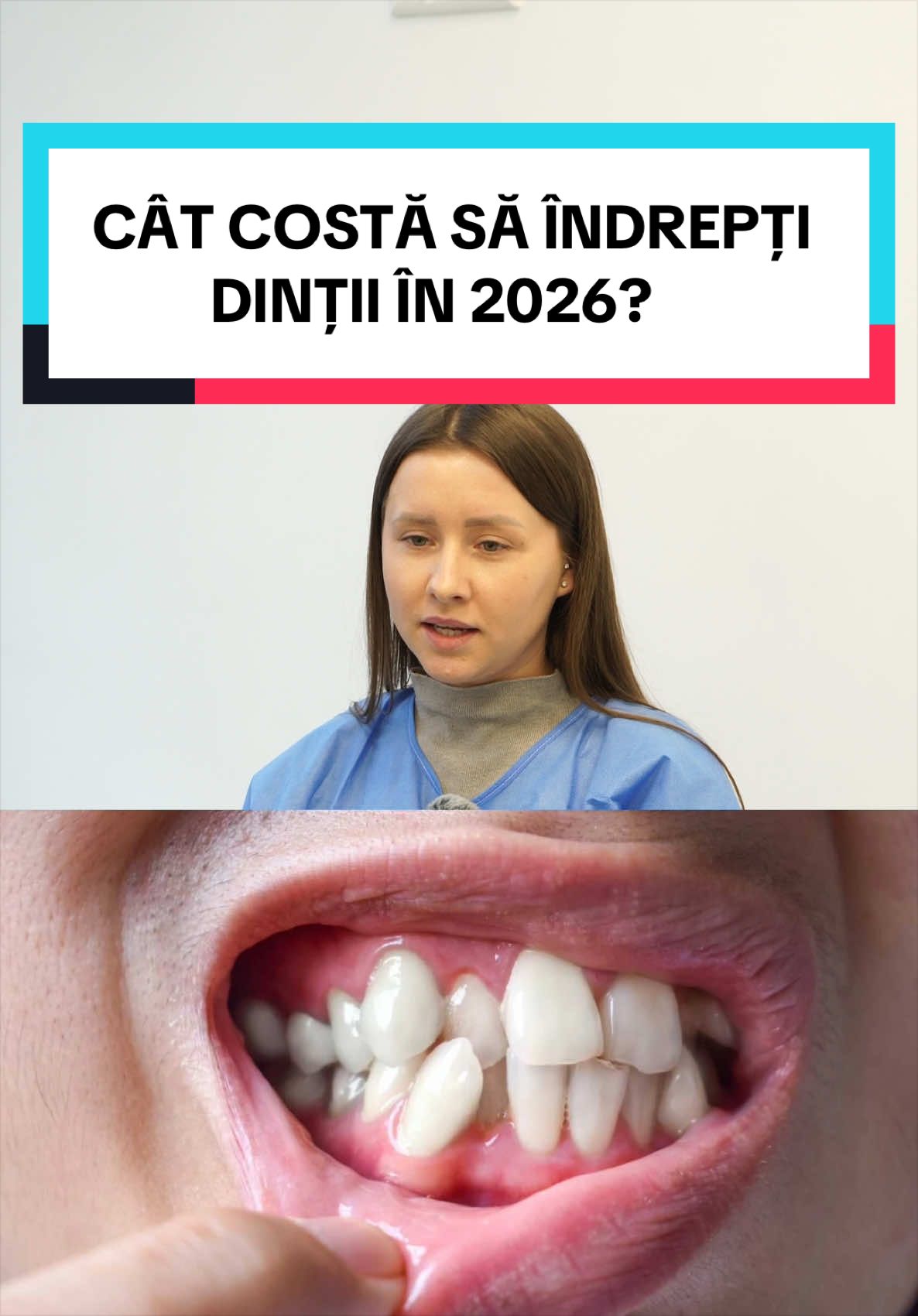 CÂT COSTĂ SĂ ÎNDREPȚI DINȚII ❓ #SYMMETRIA 