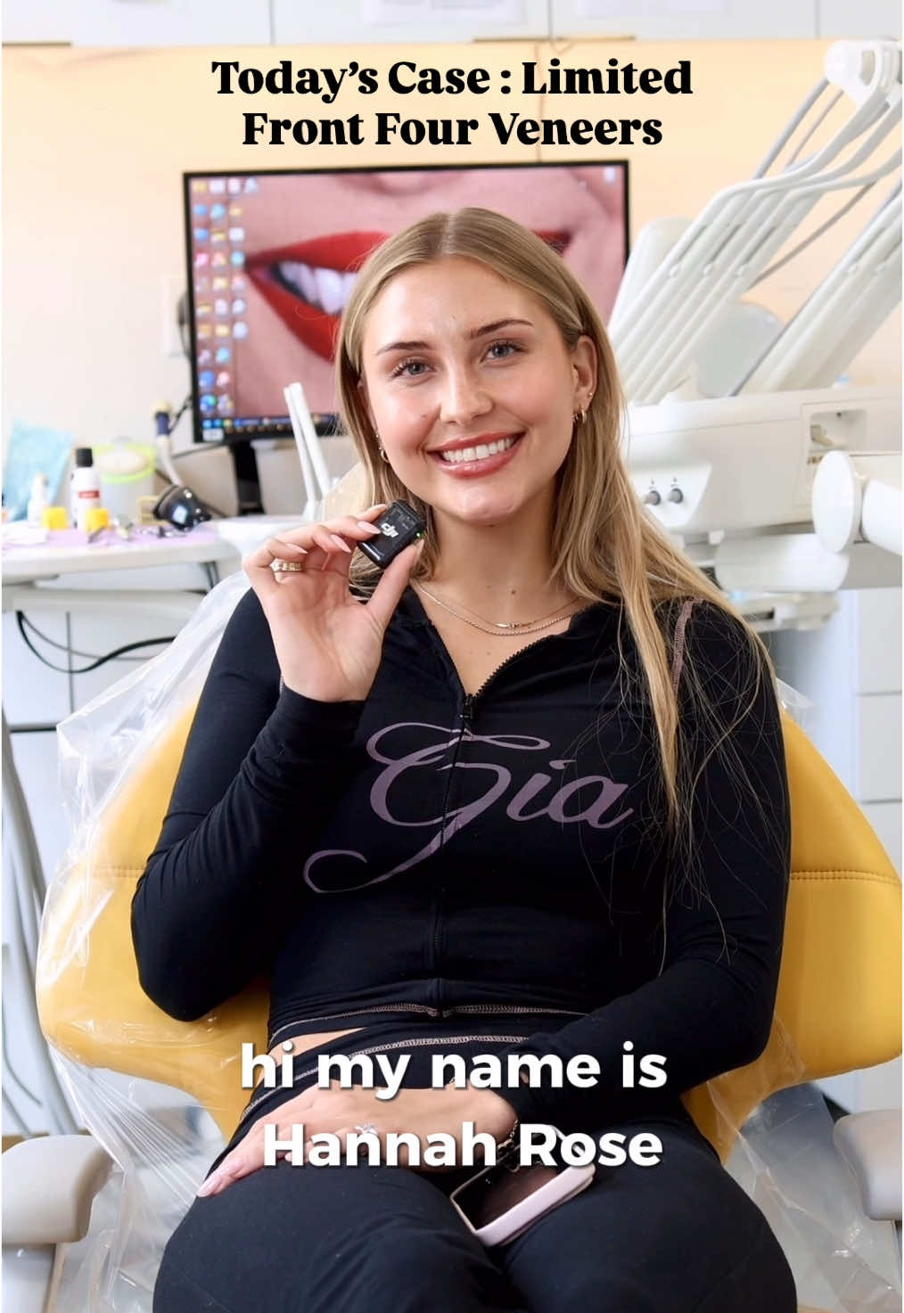 #porcelainveneers #veneers #testimonytime #dentlaveneers #frontteeth 