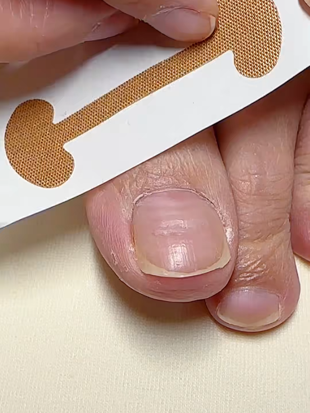 Relief starts here Toe Align Ingrown Nail Corrector Stickers 003