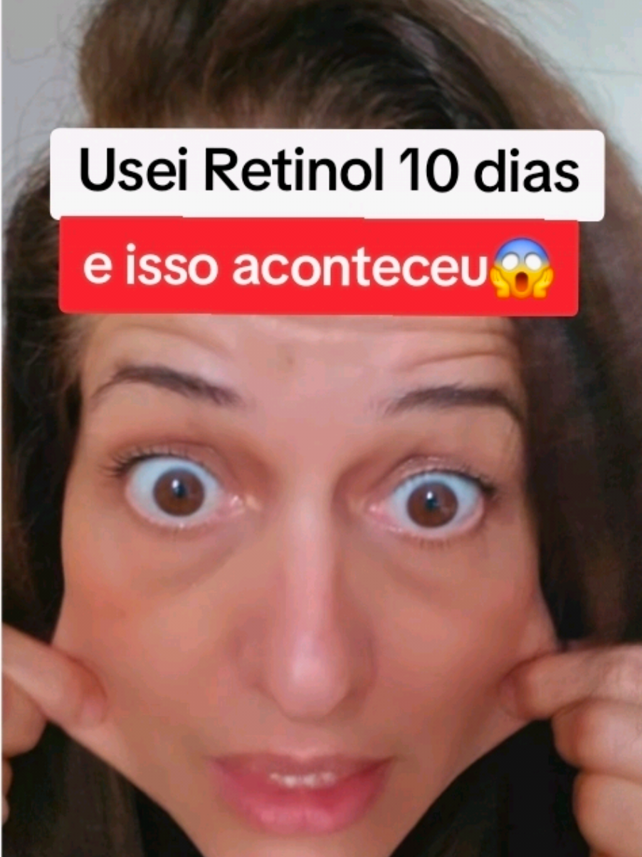 Eu não ão queria usar mil produtos diferentes… tava procurando algo pra melhorar a aparência da pele depois dos 30 e incluir um sérum com retinol na rotina noturna😏 minha pele tava com textura e linhas finas, com aspecto cansado e eu só queria algo simples pra usar no dia a dia se você também tá nessa fase de cuidar melhor da pele, aproveita #cuidadodapele  #rotinadeskincare  #retinol  #niacinamida 