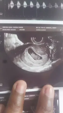 La familia está creciendo 😭😭🥺🤧🤧#parati #fyp #paratiiiiiiiiiiiiiiiiiiiiiiiiiiiiiii #embaraza #viral 