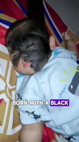 This baby was born with a black mark in her face, but what the cloctors wilu found la ter will sheck you.#LearnOnTikTok #storytime #truestory #paranormal #truestories432 