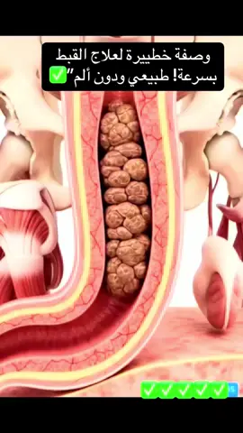 وصفة طبيعية للتخلص من القبط والإمساك بسرعية#وصفات_طبيعية #علاج_طبيعي #fyp #اكسبلور #fouryou 