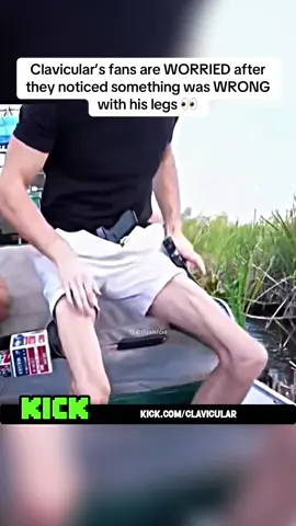 Clavicular’s fans are SCARED after they noticed something was WRONG with his legs 👀 #clavicular 