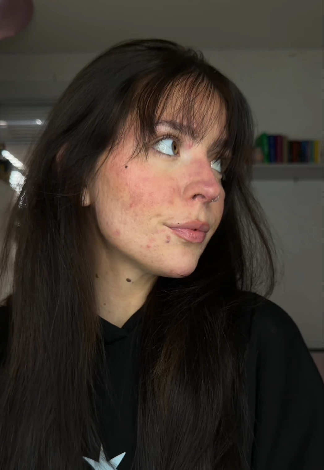 Heyyy my luvvsss I’m back🤍 #acneproneskin #fyp #makeup #BeautyTok #foryou 