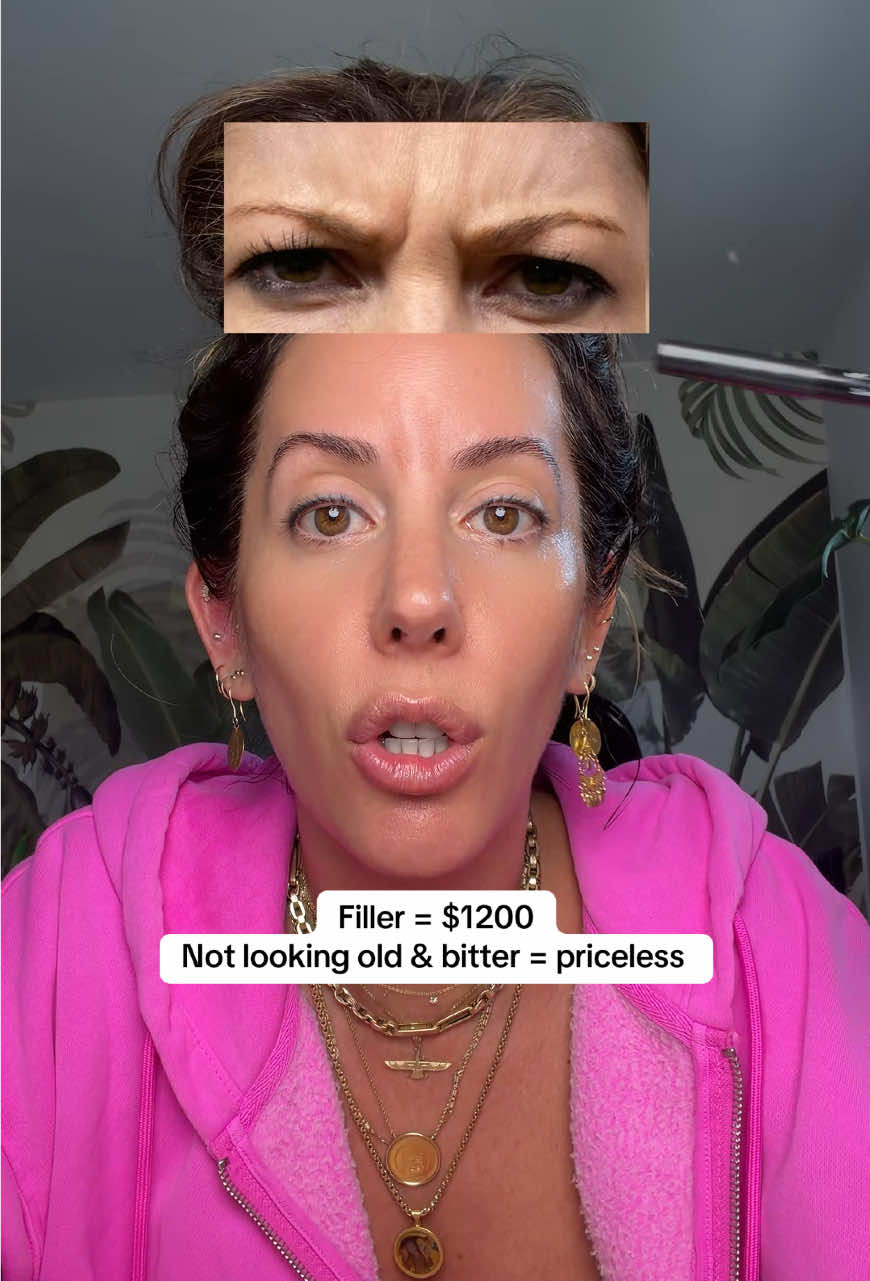 This has my face looking juicer than j-lo’s b00ty. #filler #antiaging #over40 #medicube #volufiline 
