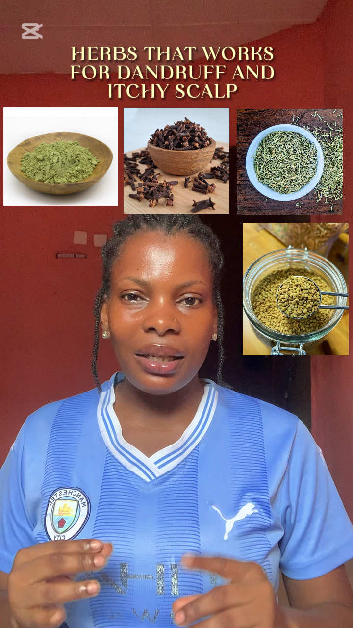 There are a lot of benefits from using herbs on your hair…  Apart from hair growth herbs works for dandruff and itchy scalp really well.  All you have to do is to be consistent and you will be surprised.. 🌱💜  #dandruffsolution  #itchyscalp  #fyppppppppppppppppppppppp  #naturalhair  #hairgrowthspray 