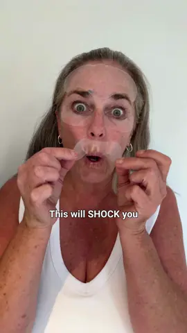 Truly jaw-dropping results after just 3 nights of patching 😱 #WrinklesSchminkles #SkincareThatSticks #WrinklePatch 