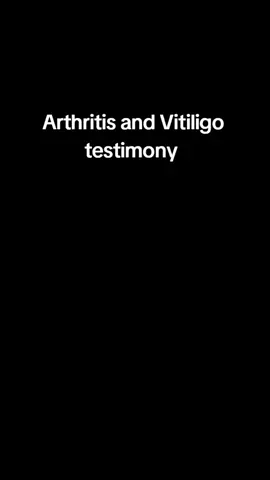 From the pain and stiffness of arthritis to the visible struggles of vitiligo — lives are being transformed every day. These powerful testimonies are a reminder that no condition is too far gone for change, hope, and restoration. Don’t give up on your health. Your testimony could be next. Talk to us, the number is on the bio #naturalhealing #jointpain #arthritis #StayAware #agcera 