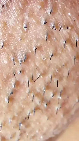 #pov #asmrvideo #hair #skincareviral 