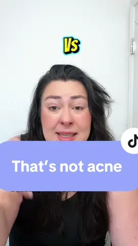 #creatorsearchinsights   That’s not acne… and if you’ve been treating it like it is you’ve been making your skin worse this whole time. @geologie