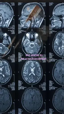 specifically neuropsychology 🤍#neuroscience #neuropsychology #neurobiology #womeninstem #fyppp 