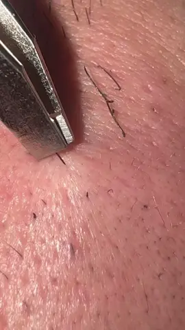 Waxing  #asmrsounds #asmrvideo #asmrtiktoks #waxing #waxingvideos 