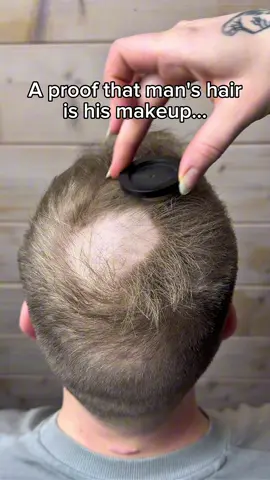 Thinning hair is optional in 2026! 🙏🤷