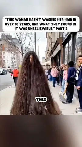 This Woman hasn't washed her hair in over 10 years. Part.2 #truestory #storytime #fypシ 
