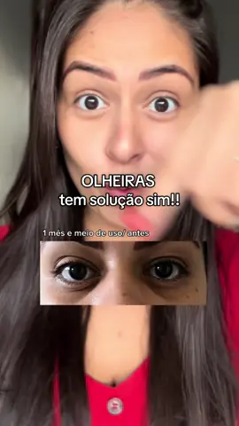 Esse serum da @Zencial devolveu minha autoestima!! Melhorou muito a cor, profundidade e aspecto das minhas olheiras ✨ como melhorar olheiras como diminuir olheiras  tratamento para olheiras o que funciona para olheiras olheiras escuras olheiras fundas bolsinhas de olheira  #skincare #olheiras #autocuidado #zencial 