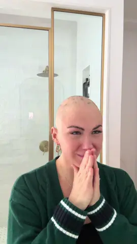 Alopecia areata universalis took all my hair… so I took control. 3 months ago 🦋 #alopeciauniversalis #hairloss #hairlossjourney #alopecia #alopeciaawareness 
