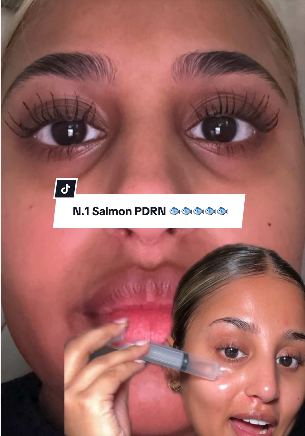 Doing my filler at home with @anua_global ad There's a 30% off sale March 25–31 #pdrn #glassskin #antiaging #koreanskincare #anuapdrn 