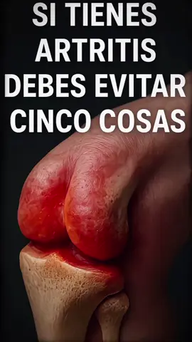 ⸻ Si sientes dolor en las rodillas, manos o cadera… no es solo la edad. Lo que comes y cómo vives puede estar empeorando tu artritis sin que lo notes. Hay 3 factores clave que inflaman tus articulaciones: ❌ El gluten ❌ El azúcar ❌ El sedentarismo Estos provocan inflamación crónica, aumentan el dolor y aceleran el desgaste del cartílago. Pero hay buenas noticias: ✨ Puedes reducir la inflamación de forma natural y mejorar tu movilidad si haces los cambios correctos. En nuestras guías te enseñamos: ✔️ Qué alimentos evitar (y cuáles sí ayudan) ✔️ Cómo reducir la inflamación naturalmente ✔️ Ejercicios seguros para tus articulaciones ✔️ Estrategias reales que sí funcionan 📲 Para más información y acceder a nuestras guías visita @desafiandoeldolor #artritis #saludarticular #inflamacion #dolor #bienestar