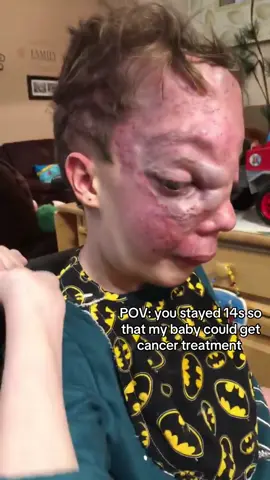 Oh this boy is a smarty #awareness #cancer #fyp #cancerawareness #fightcancer 