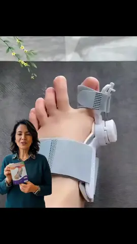 El dolor al caminar tiene solución. Corrige el juanete sin tratamientos caros.