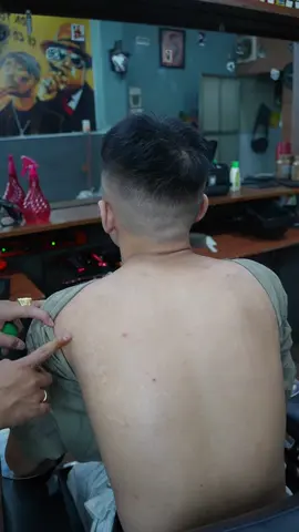 Co ai bị lan ben ko ta#triamtham #lanbena 