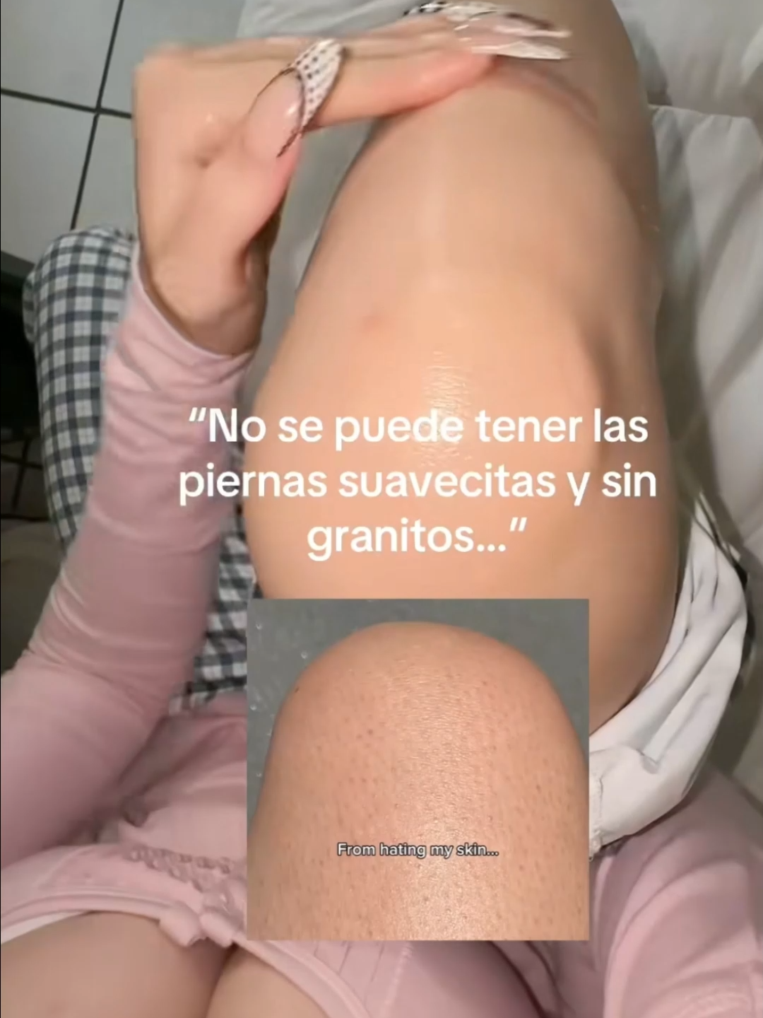 I wish I found this body wash sooner.#ventaquincenal #fypジ #fyppppppppppppppppppppppp #anCe #fyp #quarxery #acneskin #acnejourney #foryou #foryoupage #skincare #acné #bodywash #bodycare #Love #loveyou #beach #pretty