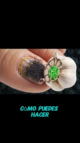 elimina hongos de uñas #paraty #parati 