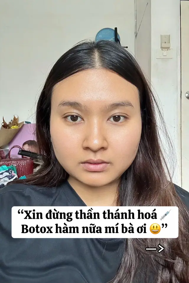 #xuhuongtiktok #fyp #filler #hanifillerbotox #hanidebeautysg 