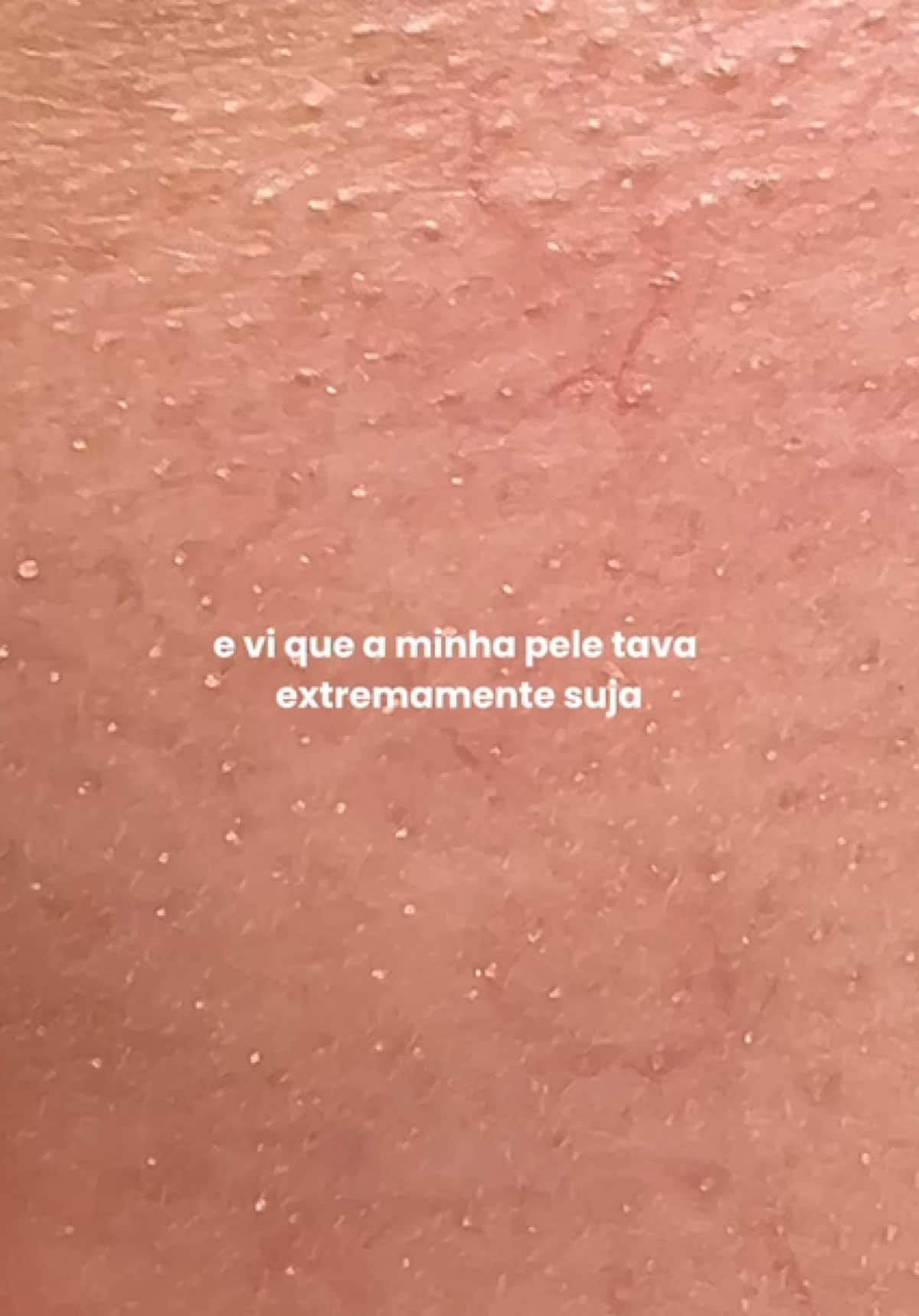 tomei um susto quando vi o estado dessa pele 