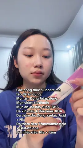 Mấy vợ mụn ẩn thử chấm cái teo đang dùng i mê #adapalene #munan #damun #dadau #xuhuong 