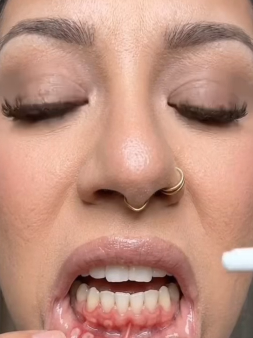 This oral spray has already gone viral on TikTok... Have you tried it?#tiktokshop #toothcaretips #toothcare #toothache #fyp