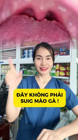 Nhiều anh chị hay nhầm với sùi mào gà #hatlympho #viemgailuoi #viemhonghat #nuocsucmieng #dabavi 
