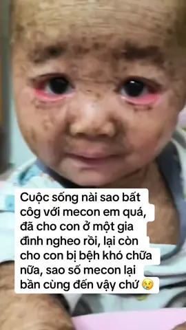 Cuộc sốg nài thật không công bằg với mecon em 🥺 #med#medona#thanmotn#minhnuoin#conbenh 