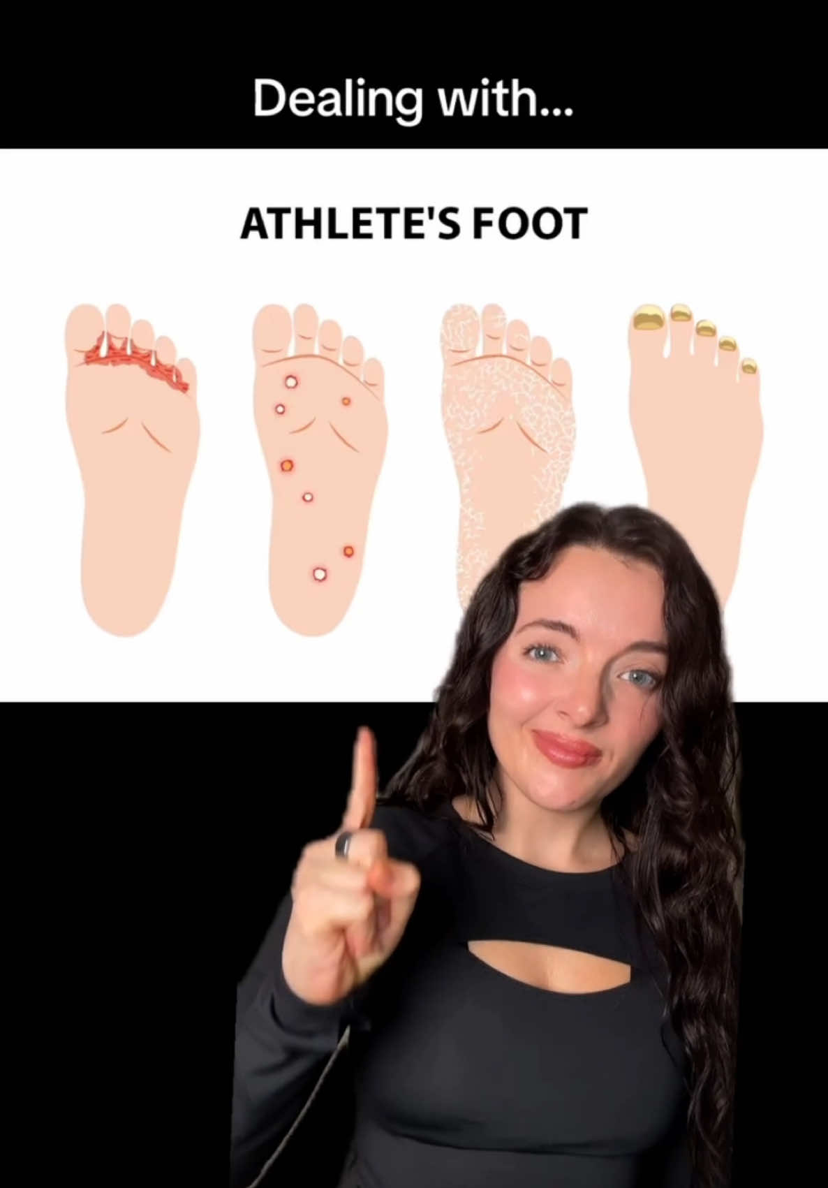 Hot weather + moisture = athlete's foot 🦶  Terrasil Antifungal treats athlete's foot fast, so you don't need to miss out on fun plans with friends this summer. Shop Terrasil on our TikTok Shop and save! #Antifungal #AthletesFoot #fungalinfection #clotrimazole 