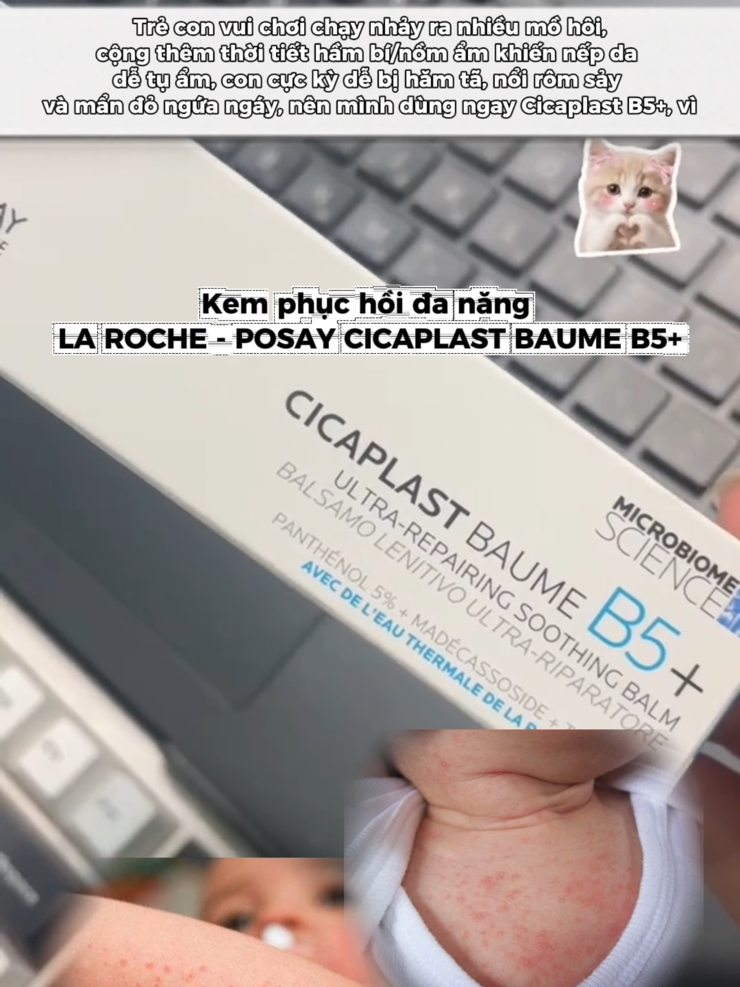 Trẻ con vui chơi chạy nhảy ra nhiều mồ hôi, cộng thêm thời tiết hầm bí/nồm ẩm khiến nếp da dễ tụ ẩm, con cực kỳ dễ bị hăm tã, nổi rôm sảy và mẩn đỏ ngứa ngáy, nên mình dùng ngay Cicaplast B5+ Sử dụng sản phẩm phục hồi da để hỗ trợ tái tạo và giúp da nhanh chóng khỏe lại 🌿   #larocheposayvn  #cicaplast