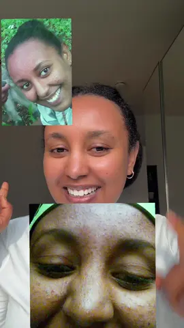 #skincaretips#