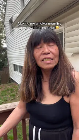 that had me shook ngl😅 #teethwhitening #yellowteeth #transformation #relatable #viral 
