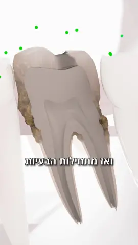 עברתם לטבעי? מעולה. אבל משחת השיניים הטבעית שלכם כנראה לא מחסלת חיידקים. היא מנקה, אבל לא מנטרלת את החיידקים שגורמים לעששת, דלקות חניכיים וריח רע.