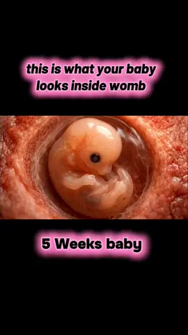 this is what your baby looks inside womb week by week #babyinwomb☺ #babyinwomb🤰🏻 #fetaldevelopment #babyintummy #babyinsidebelly #viralvideo 